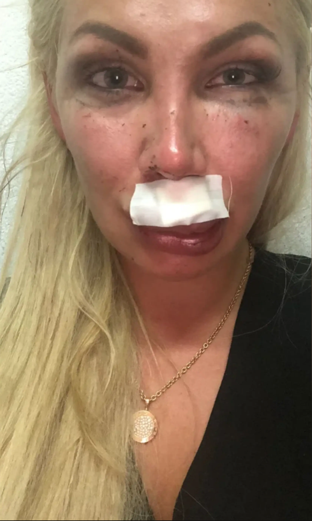 Lia Balanovská po útoku
