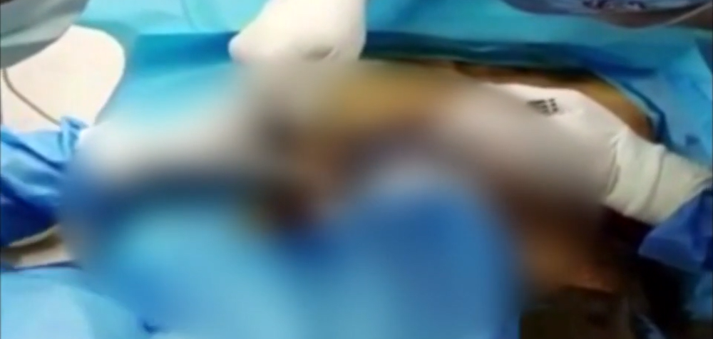 falosny plasticky chirurg 1