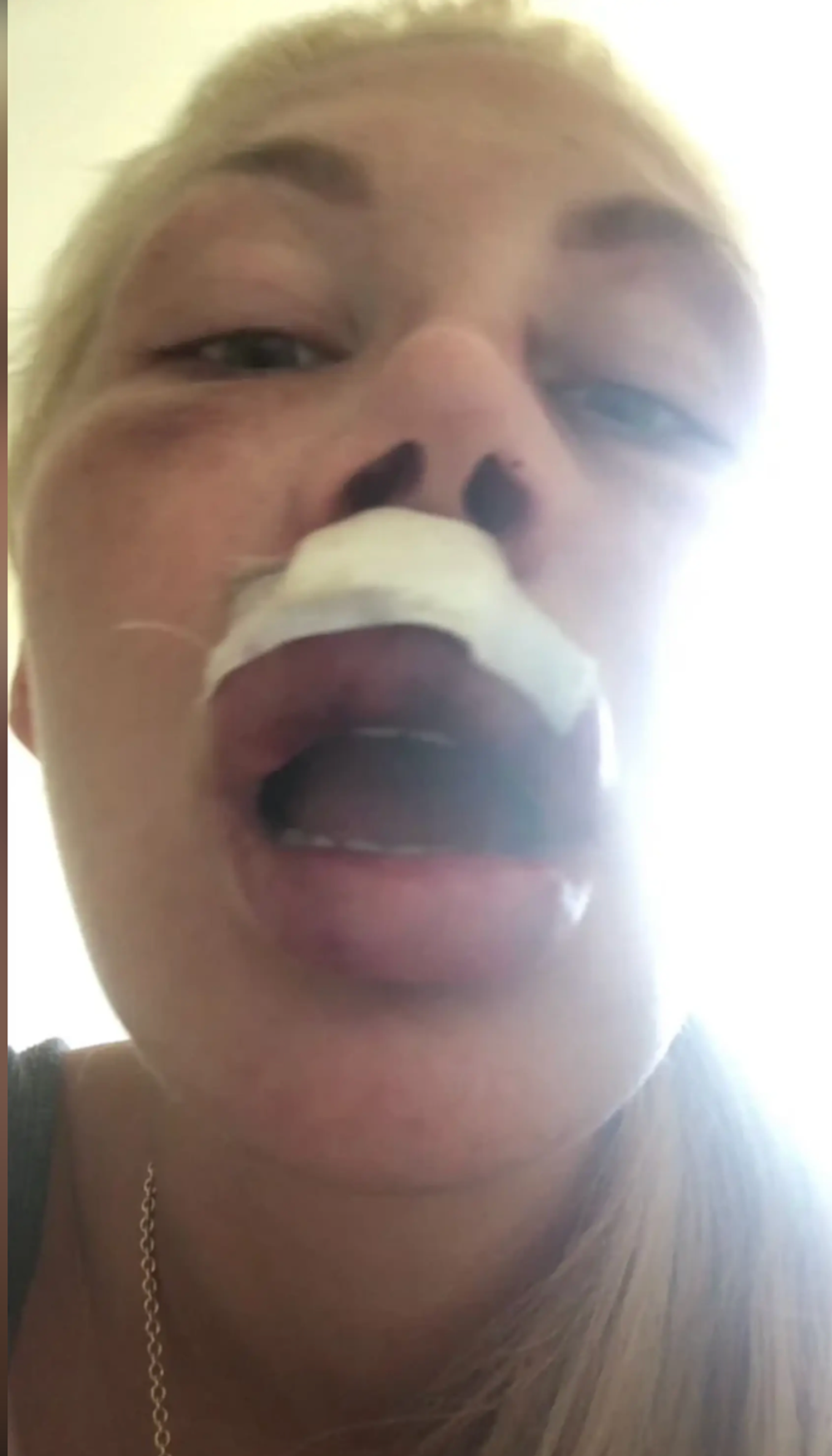 Lia Balanovská po útoku
