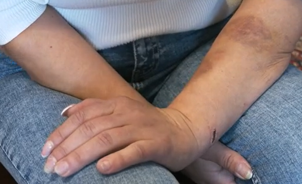 Muž držal ženu týždeň v aute 12