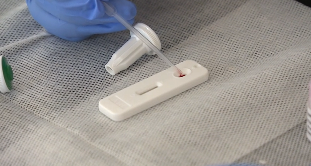 Testovanie AIDS