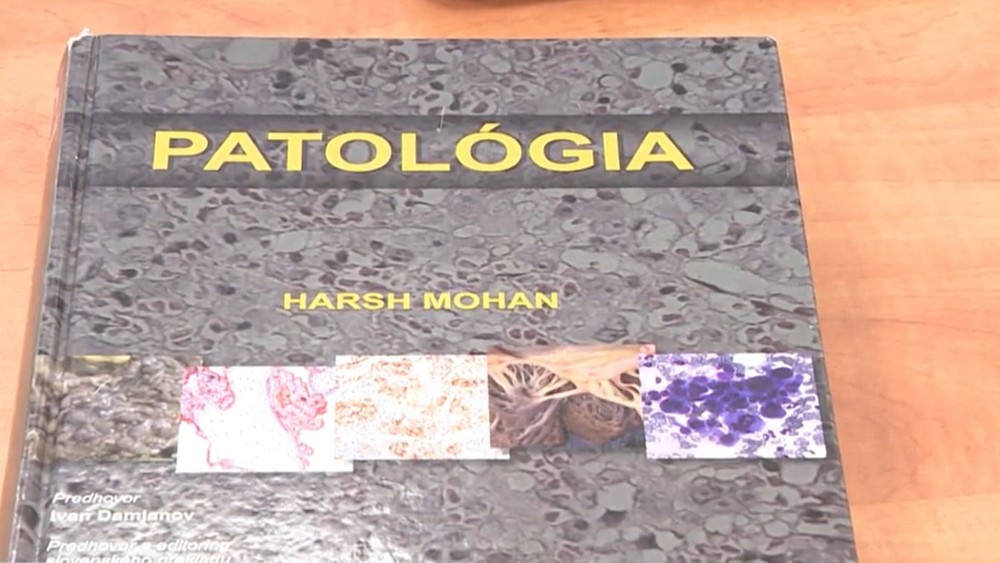 Nový systém prehliadok mŕtvych tiel už funguje.