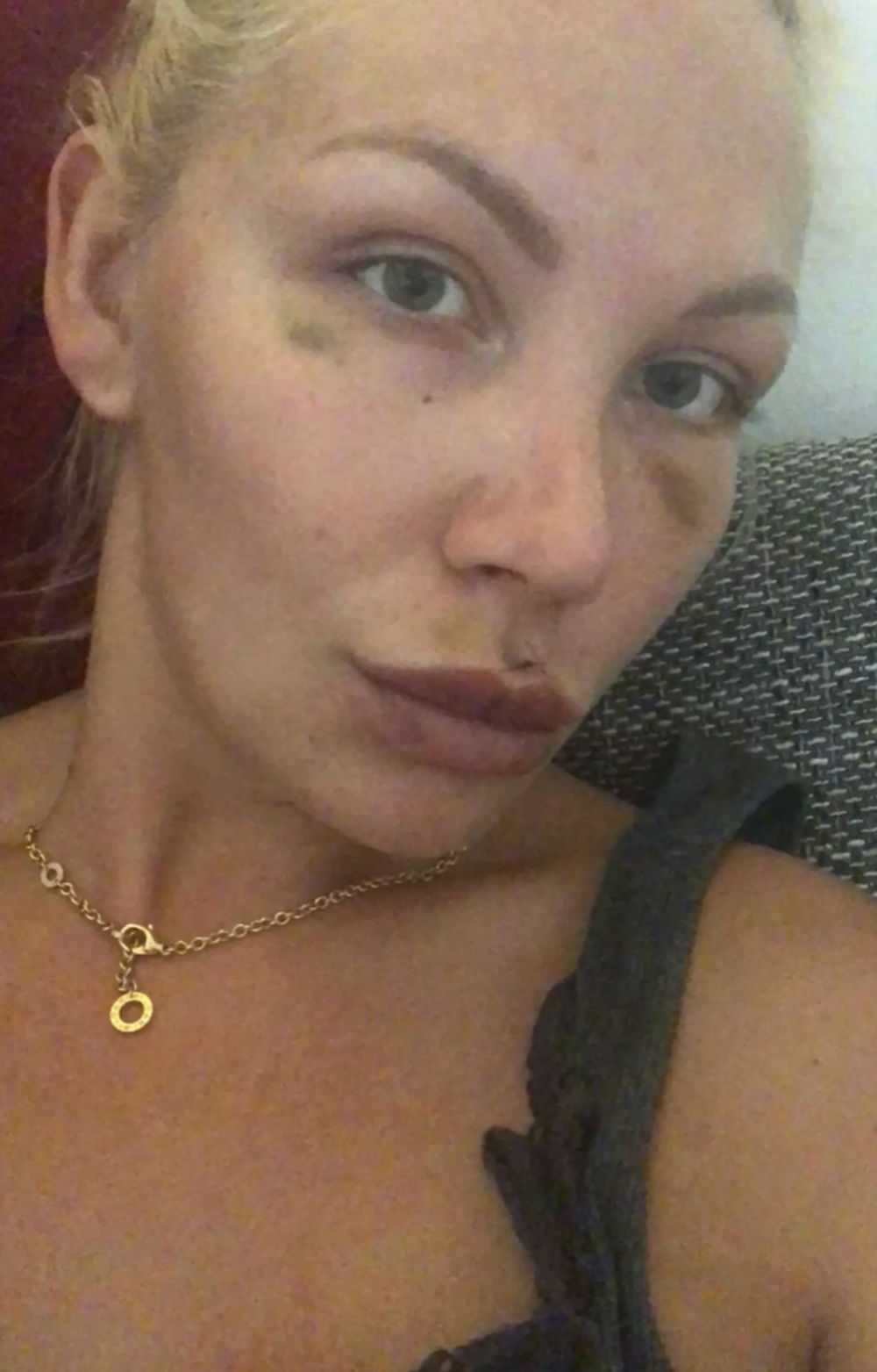 Lia Balanovská po útoku