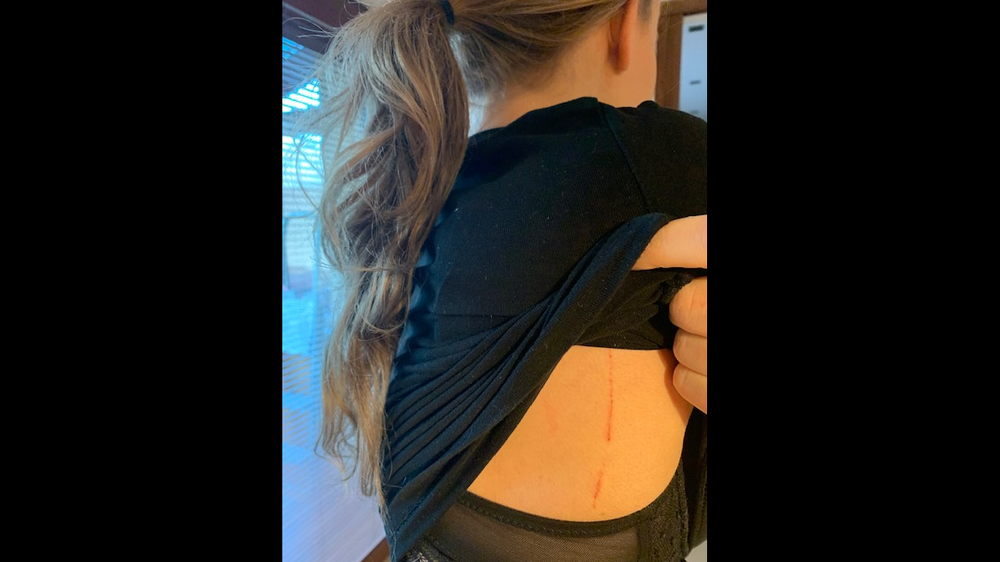 Dcéra Brhela opísala neprimeraný zásah NAKA