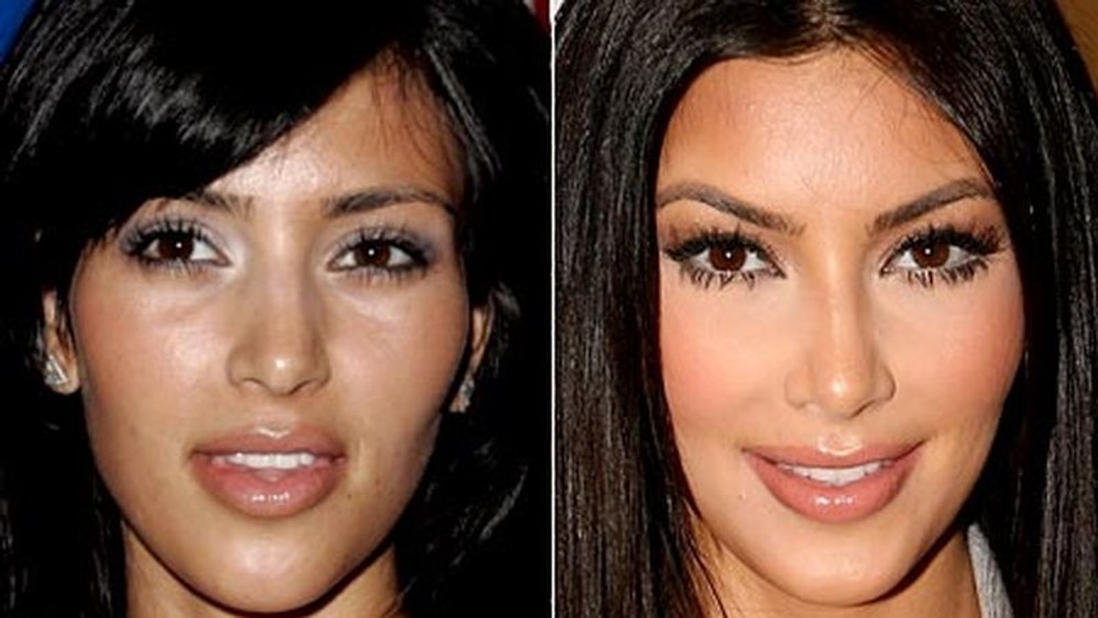 Kardashianky a ich rodina Kim Kardashian - plastiky 2
