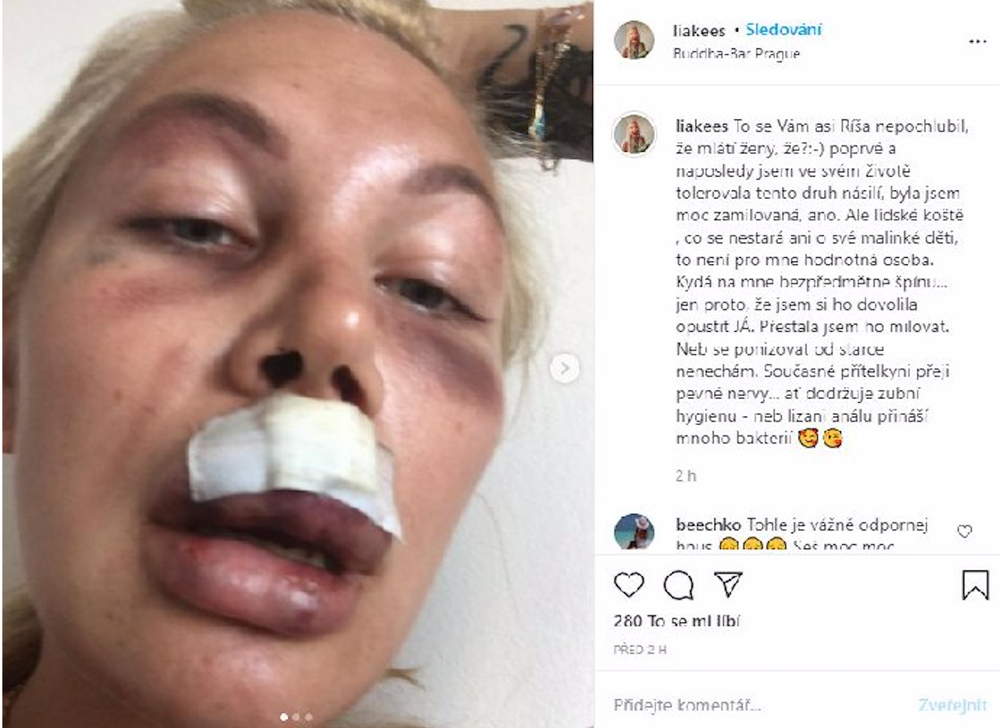 Lia Balanovská po útoku