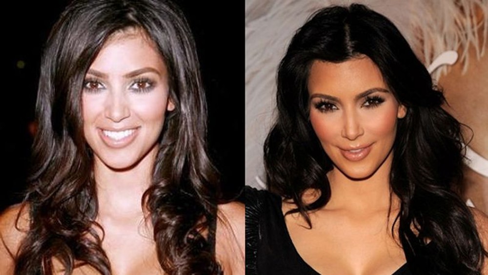 Kardashianky a ich rodina Kim Kardashian - plastiky 3