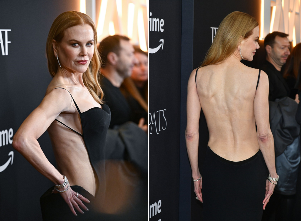 nicole kidman