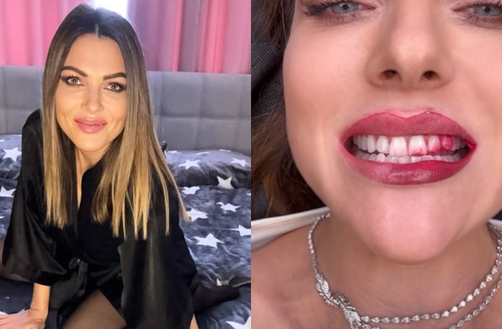 Martina Schindlerová šokovala KRVAVÝM úsmevom: Fanúšikovia sa zľakli, čo sa jej stalo!