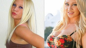 Amy (23) chcela veľké prsia. Sen jej splnili darcovia