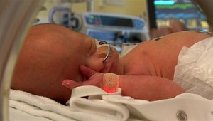 Jedinečná operácia bábätka v maternici