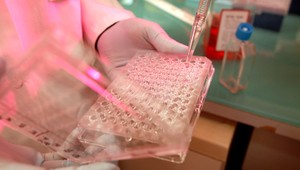 Pracoval na vývoji vakcíny. Nakazil sa ale a zomrel