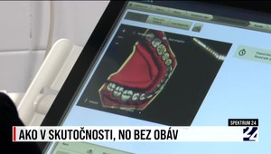 Spektrum 24 o modernej príprave medikov