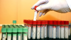 Žilinčan (24) nakazený HIV si zarábal prostitúciou