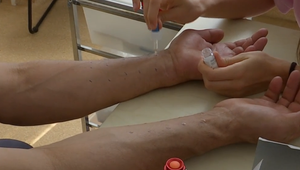 Štúdio 24 o detských alergiách a o tom, ako na ne