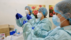 NCZI má opäť technické problémy. Časť ľudí získa nový termín na očkovanie