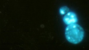 Nádej v boji proti rakovine. Vedci otestovali nové liečivo