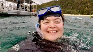 Už ako tínedžerka si musela holiť tvár: Po rokoch odhodila žiletky a TAKTO vyzerá