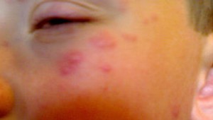 Osýpky prekročili hranice Prahy a blížia sa k tým našim