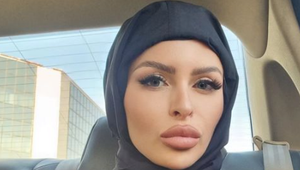 Ceterová odcestovala do Iránu na plastiku! Chce podstúpiť TIETO zmeny na tvári!