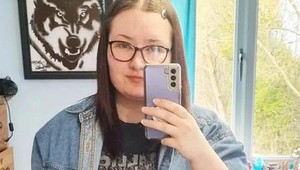 Laura ukázala šokujúce FOTO pred zmenšením hrudníka: Mega prsia jej ničili život!