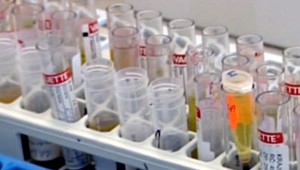 9 otázok a odpovedí o anabolických steroidoch: Aké je najväčšie riziko ich užívania?