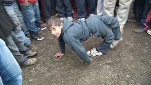 Rómsky chlapec chodí ako pes. Lekári mu zmenia život