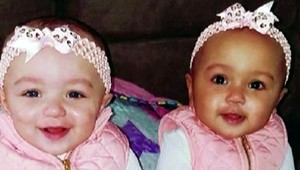 Žena porodila dvojičky s odlišnou farbou pokožky