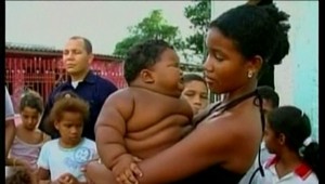 Obezita nebolí, no môže byť začiatkom mnohých civilizačných ochorení