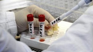 Hygienici zaznamenali na Slovensku najvyšší počet HIV pozitívnych od roku 1985