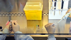 NAŽIVO Z ČR: Všeobecná fakultná nemocnica o podaní experimentálneho lieku pacientovi s COVID-19