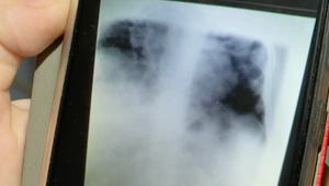 Obeť Covidu -19: Röntgen si robil vo veterinárnej ambulancií