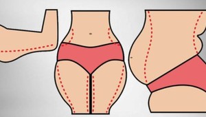 TOP chudnúce triky, ktoré zaberú, aj keď nebudete cvičiť: Vyskúšajte ich hneď!