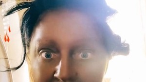 Žena chcela vyzerať príťažlivejšie, použila falošné opálenie: Tú katastrofu musíte vidieť!