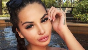 Zuzana Plačková vytasila svoj zadok na obdiv: Takto vyzerá jej vylepšené pozadie po plastike!