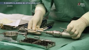 Neurochirurgička nechala svoju dcéru (13) vŕtať pacientovi do hlavy