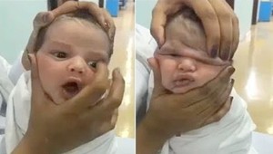 Príšerné! Celý svet je zdesený z toho, čo zdravotné sestry spravili novorodencovi