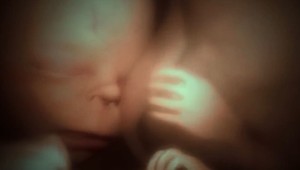 Ako to vyzerá v brušku pri pôrode? Zábery, ktoré vám vyrazia dych!