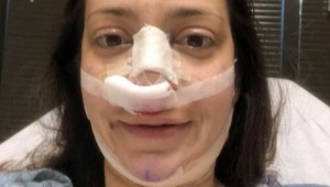 Chcela byť ako Meghan Markle: Čo poviete, podobá sa po plastikách na svoj idol?