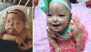 Vlastný jazyk ju mohol zadusiť, dnes sa konečne smeje