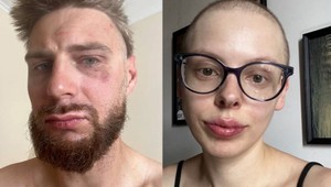 Poliak chcel vyzbierať peniaze pre partnerku s rakovinou. V Ostrave ho zbili pre modrožltú čiapku