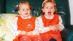 Z týchto jednovaječných dvojčiat sú už dospelé ženy: Neuveríte, ako vyzerajú!