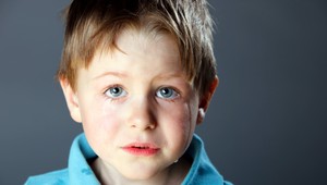 Chlapec s nalakovanou hlavou sa hral so zapaľovačom, o vlasy prišiel