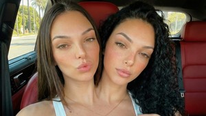 Najkrajšie siamské dvojičky na svete šokujú internet: Zázrak prírody alebo dokonalý podvod?