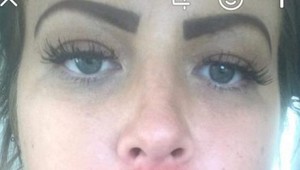 Žena sa chcela zbaviť drobných fúzikov, ľudia ju vysmiali: Aha, ako hrozne dopadla!