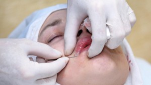 Neuveriteľné FOTO influencerky pred a po plastike: Prvý zákrok podstúpila už na základnej škole