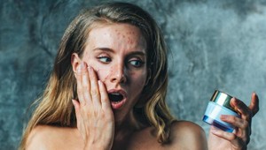 Zázrak menom Bi-Oil: Funguje na jazvy po akné? Tu je dôkaz!