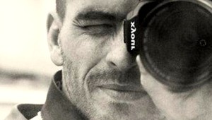 Útok psa. Fotografovi Michalovi (39) všili ucho do brucha