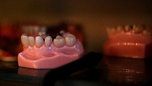 Dôchodca sa sťažoval na bolesť krku. Počas operácie mu tam nechali zapadnutú zubnú protézu