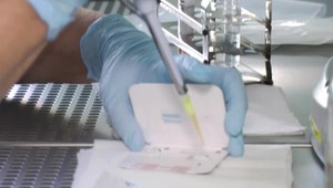 Na Slovensku sú už nové vakcíny proti chrípke. Lekári ich odporúčajú, pacienti sa ich ale obávajú